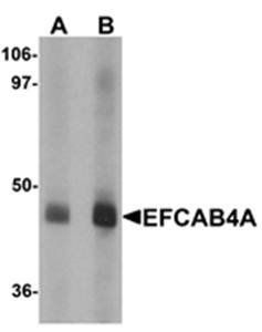 EFCAB4A Antibody