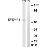 EFEMP1 antibody