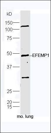 EFEMP1 antibody
