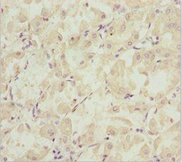 EFHC1 Antibody