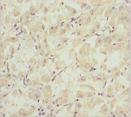 EFHC1 antibody