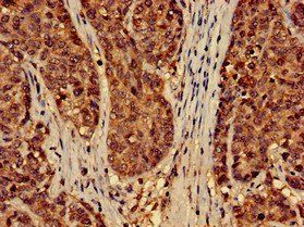 EFHD2 Antibody