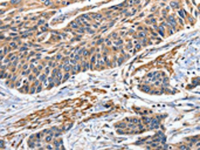 EFNB2 Antibody