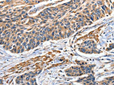 EFNB2 antibody