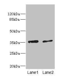 EFNB3 Antibody