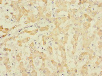 EFNB3 antibody