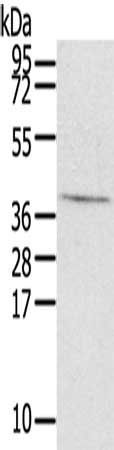 EFNB3 Antibody