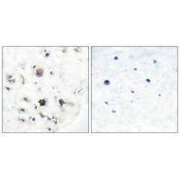 EFNB3 antibody