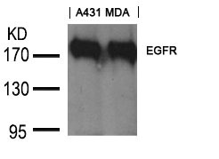 EGFR (Ab-1197) antibody
