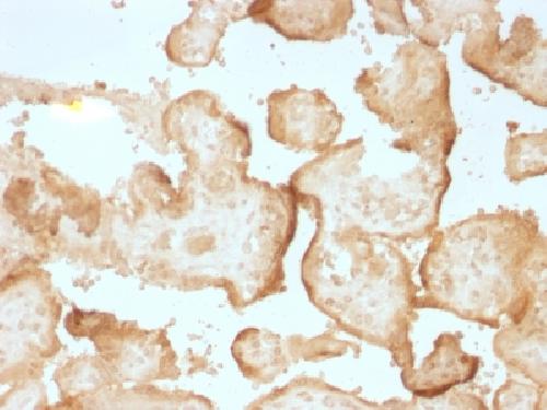 EGFR Antibody