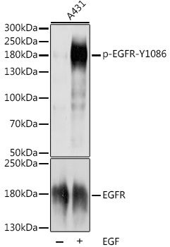 EGFR (Phospho-Y1086) antibody