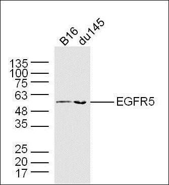 EGFR5 antibody