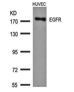EGFR (Ab172) Antibody