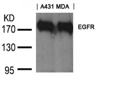 EGFR (Ab197) Goat Polyclonal Antibody