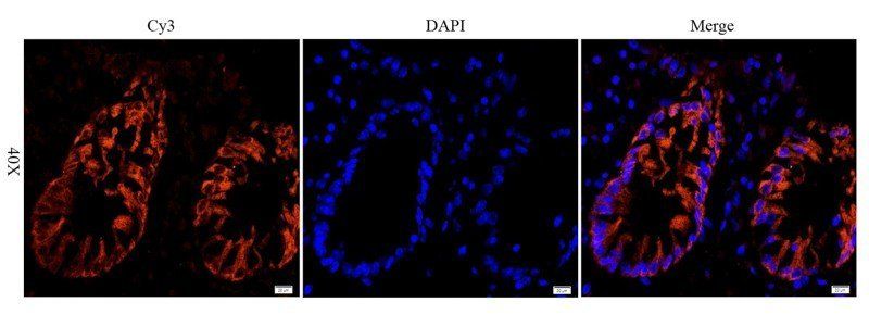 EGFR isoform a variant antibody