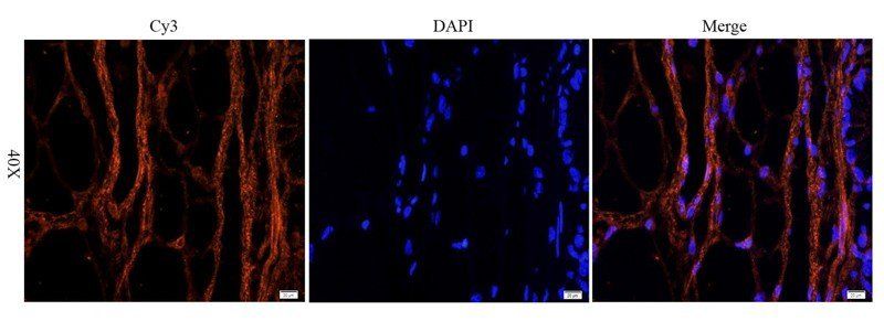 EGFR isoform a variant Rabbit Polyclonal Antibody