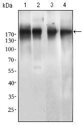 EGFR mutant (L858R)