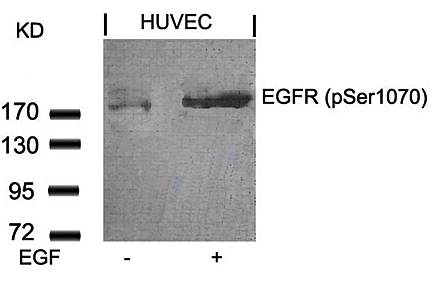 EGFR (Phospho-Ser1070) Antibody