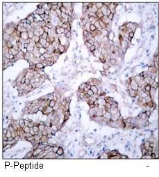 EGFR (Phospho-Tyr1092) Antibody