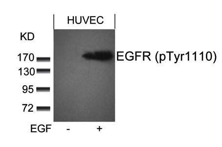 EGFR (phospho-Tyr1110) Antibody