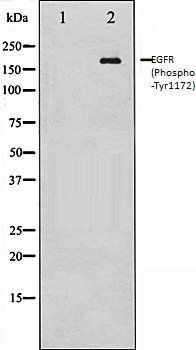 EGFR (Phospho-Tyr1172) antibody