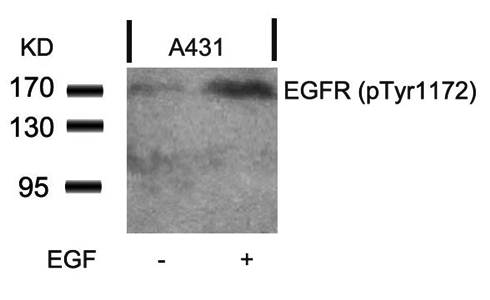 EGFR (Phospho-Tyr1172) Antibody