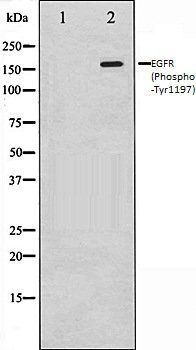 EGFR (Phospho-Tyr1197) antibody