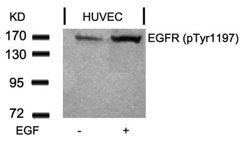 EGFR (Phospho-Tyr1197) Antibody