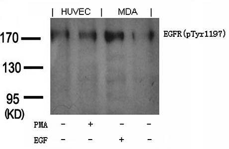 EGFR (phospho-Tyr1197) Goat Polyclonal Antibody
