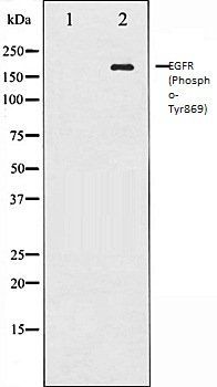EGFR (Phospho-Tyr869) antibody