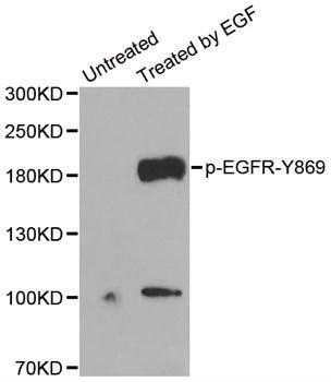 EGFR (phospho-Y869) antibody