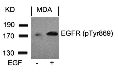 EGFR (Phospho-Tyr869) Antibody
