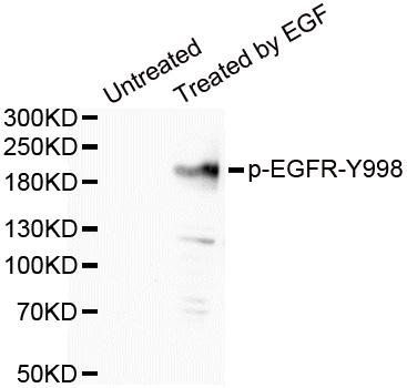 EGFR (phospho-Y998) antibody
