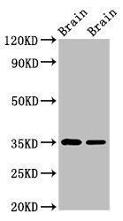 Egl nine homolog 3 antibody
