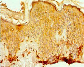 EGLN1 antibody