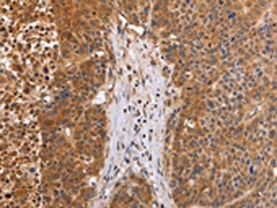 EGLN3 Antibody