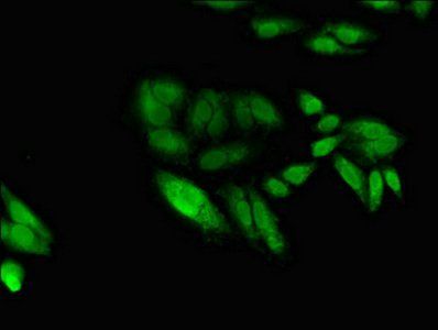 EGR2 Antibody