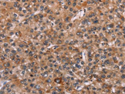 EGR4 Antibody