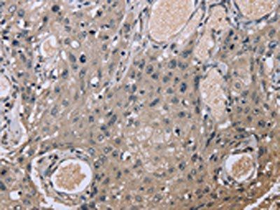 EID1 Antibody