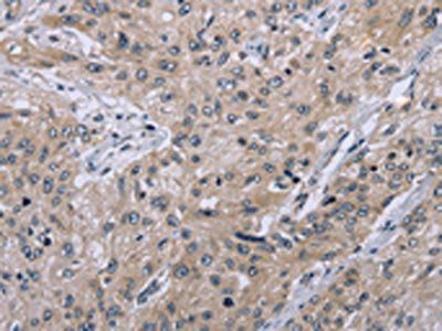 EID1 Antibody