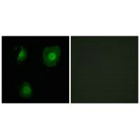 EID1 Antibody