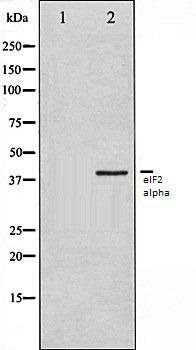 eIF2 alpha antibody
