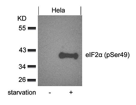eIF2α (phospho-Ser49) Antibody