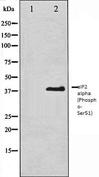 eIF2 alpha (Phospho-Ser51) antibody
