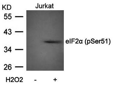eIF2α (Phospho-Ser51) Antibody