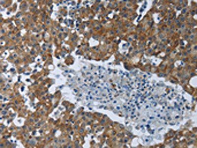 EIF2AK2 Antibody