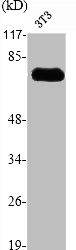 EIF2AK2 Antibody