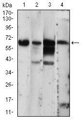 EIF2AK2 Antibody