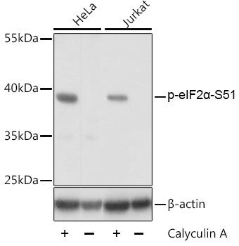 eIF2alpha (Phospho-S51) antibody