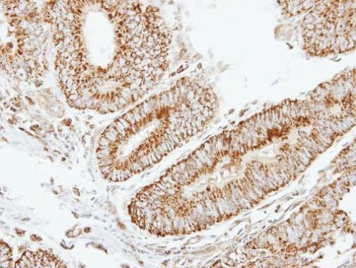 EIF2B beta Rabbit Polyclonal Antibody